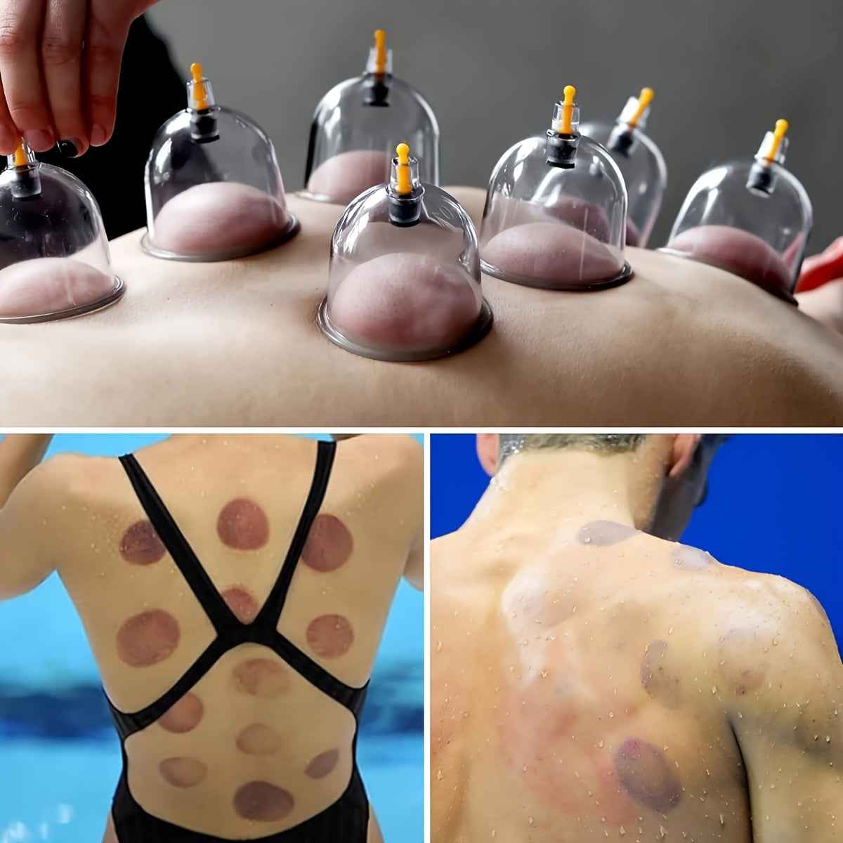 Ventouses Relax – Kit Hijama Complet avec Pompe