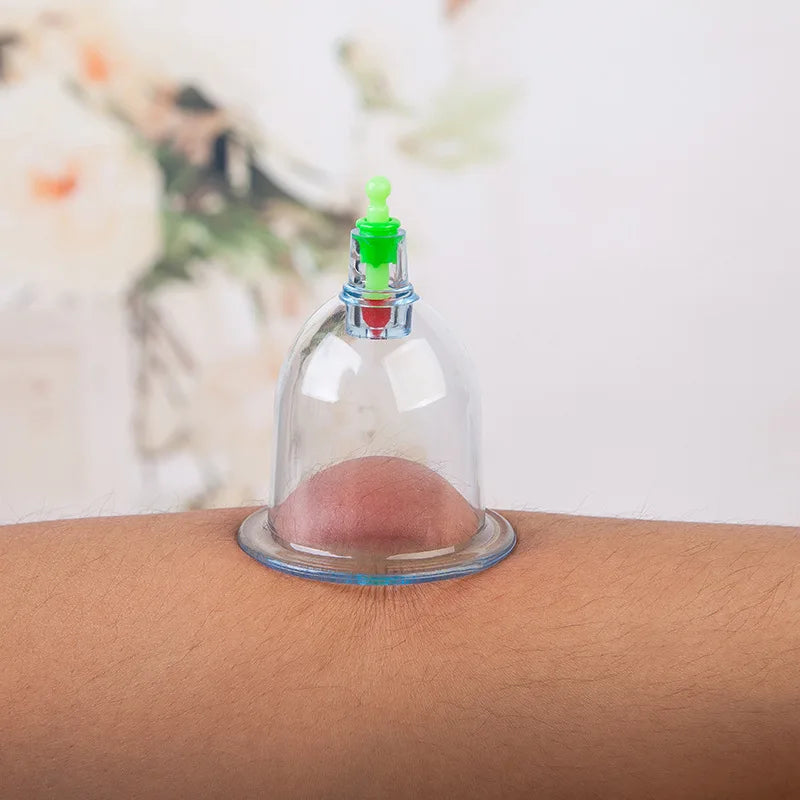 SET HIJAMA ESSENTIEL — 6 Ventouses + Pompe Pro