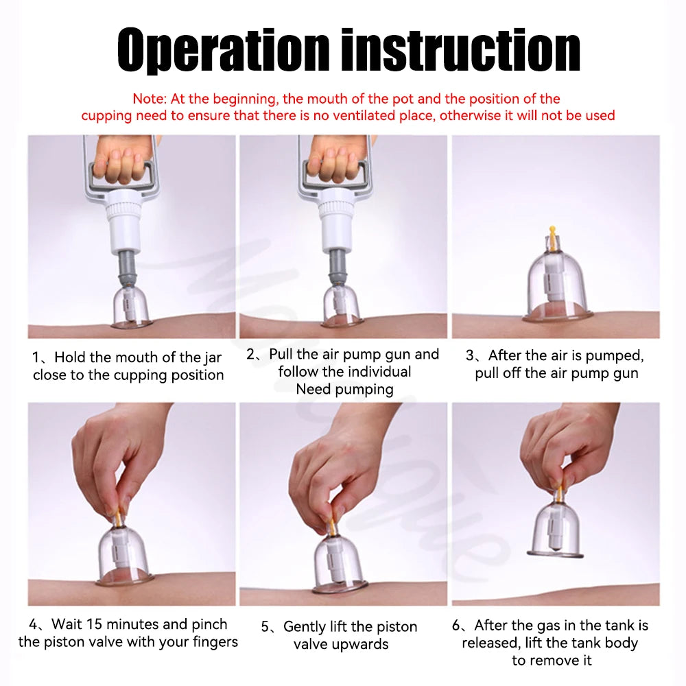 SET HIJAMA PRO — 12 Ventouses + Pompe